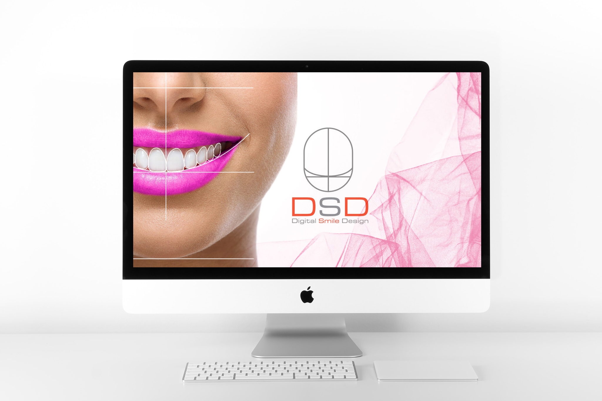 DSD數位微笑設計-微笑設計-推薦-台中-潔晞美顏美齒